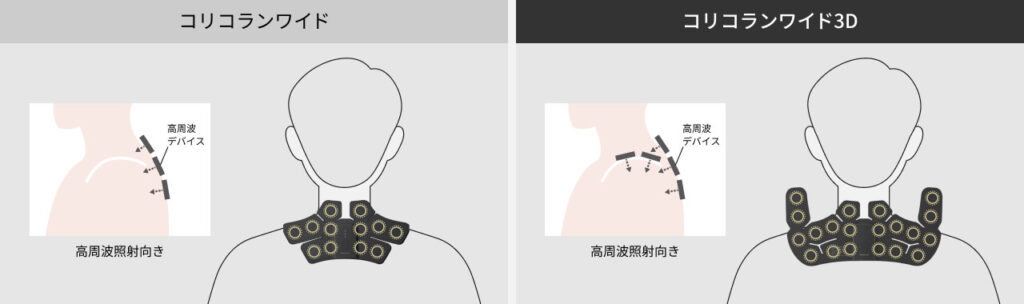 コリコランワイドとコリコランワイド3Dの高周波照射方向の違い